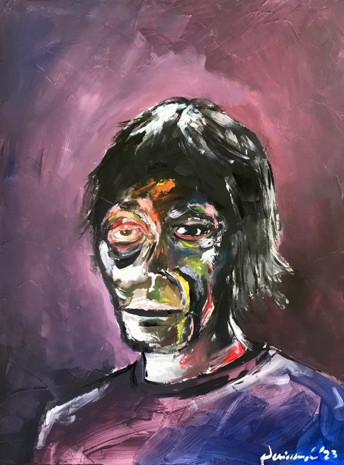 Self portrait with eye injury